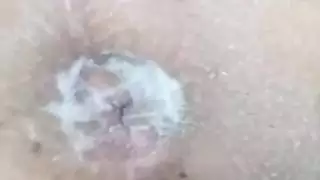شرج قاسي: أدخل زبك