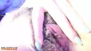 مهبل بارز